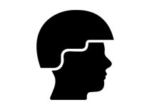 Helmet- avoiding hair loss